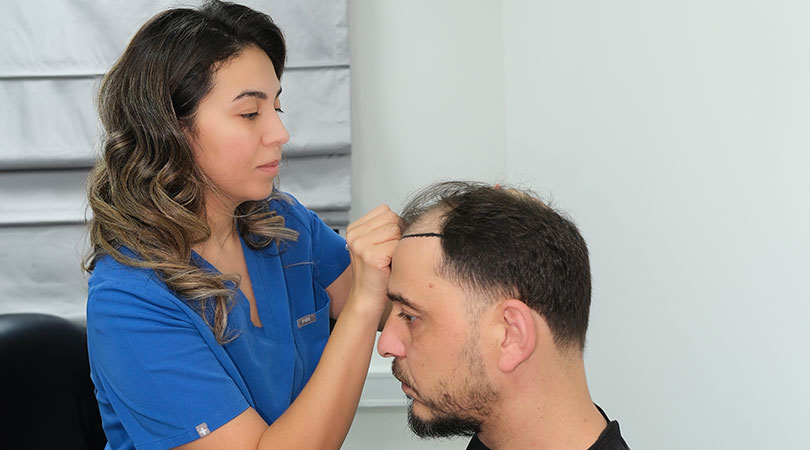 Haartransplantatie in Istanbul